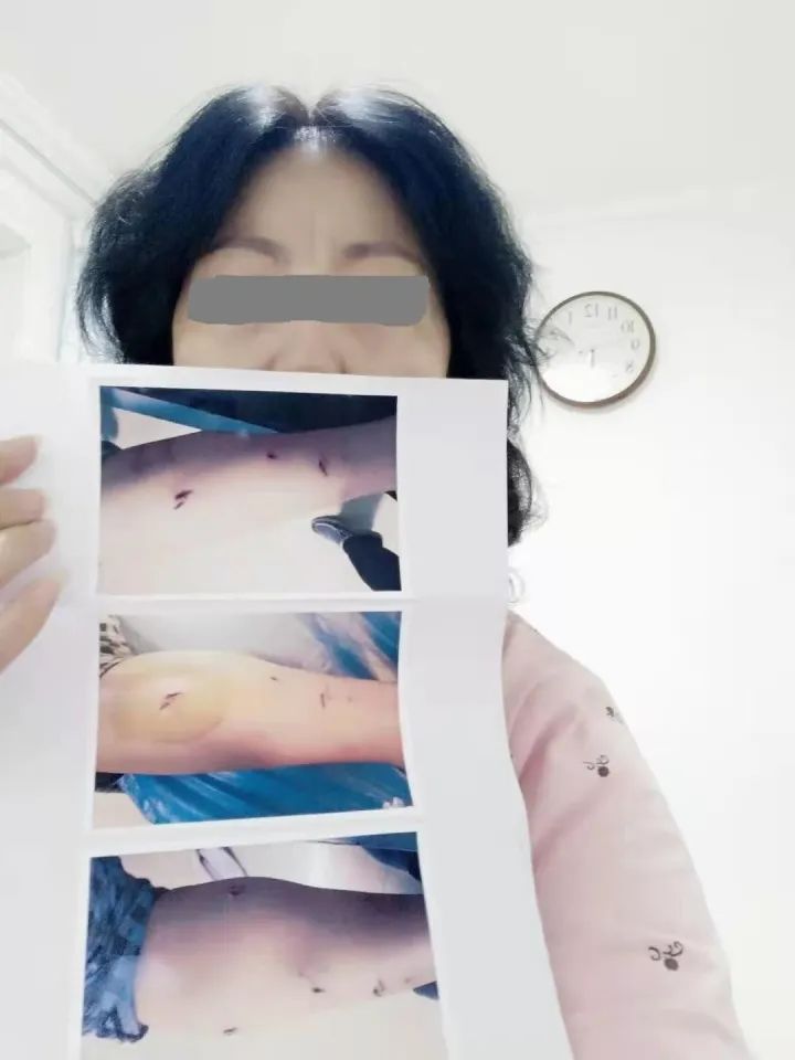 女子被狗咬傷，輾轉(zhuǎn)打疫苗花費(fèi)2萬多