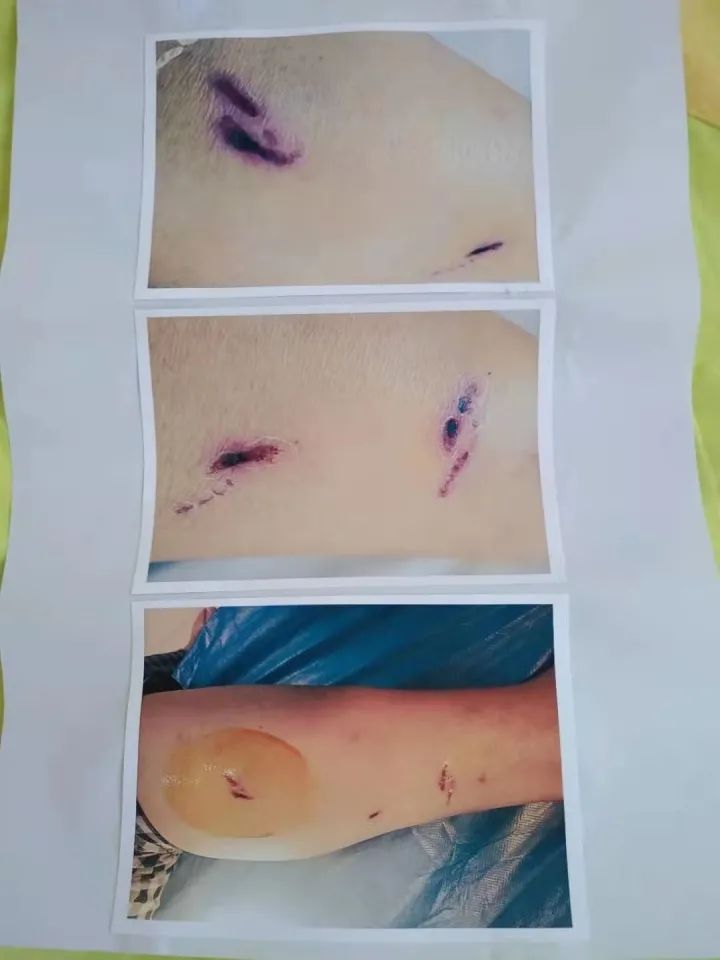 給狗接種狂犬疫苗_狂犬疫苗狗_狗狂犬疫苗多少錢